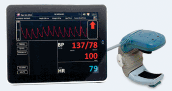 Image: The TL-300 noninvasive blood pressure monitor (Photo courtesy of Tensys Medical).